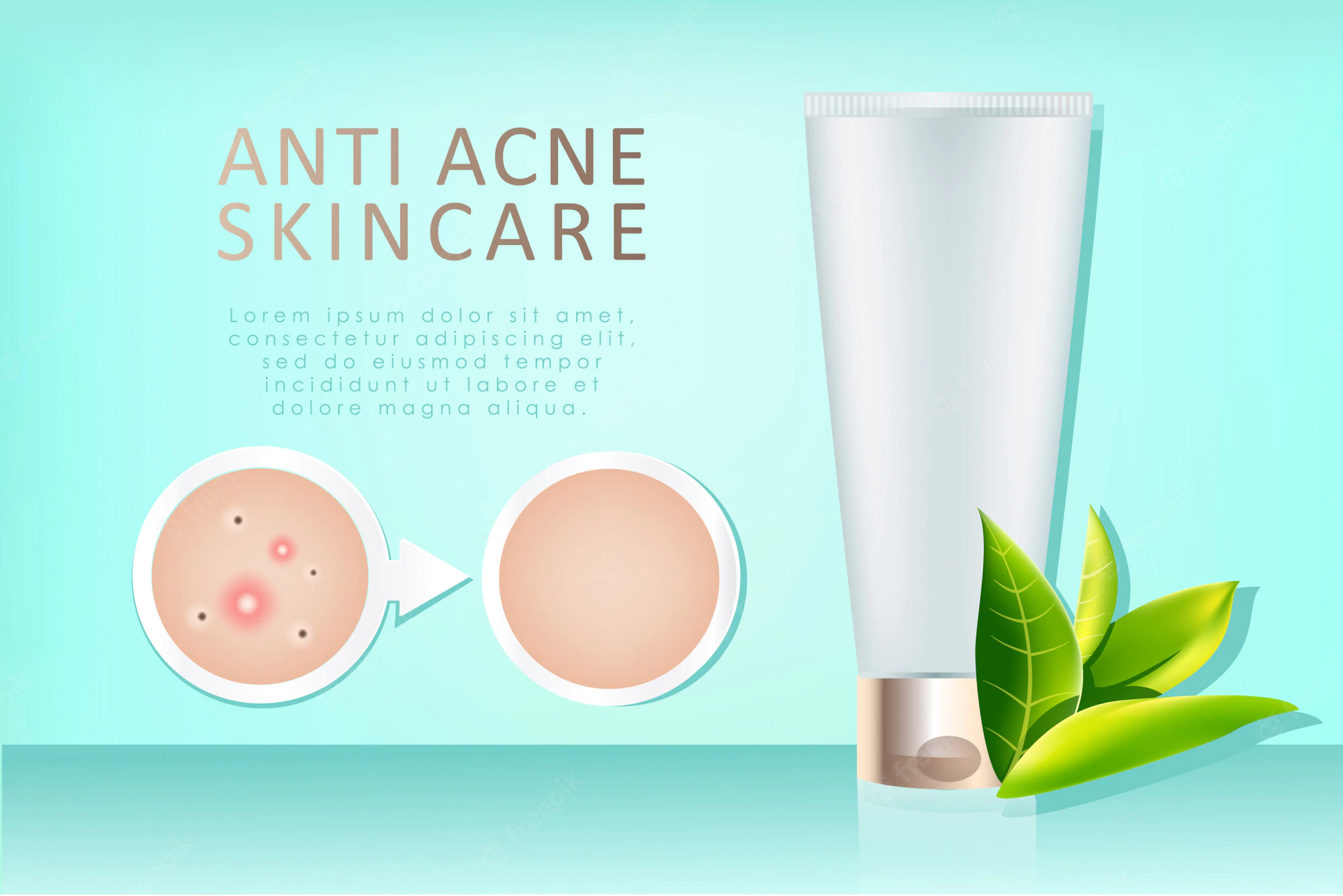 ani acne