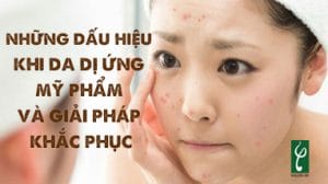 di ung my pham