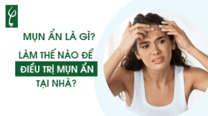 MUN AN LA GI