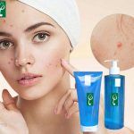 Gia công sữa rửa mặt da mụn