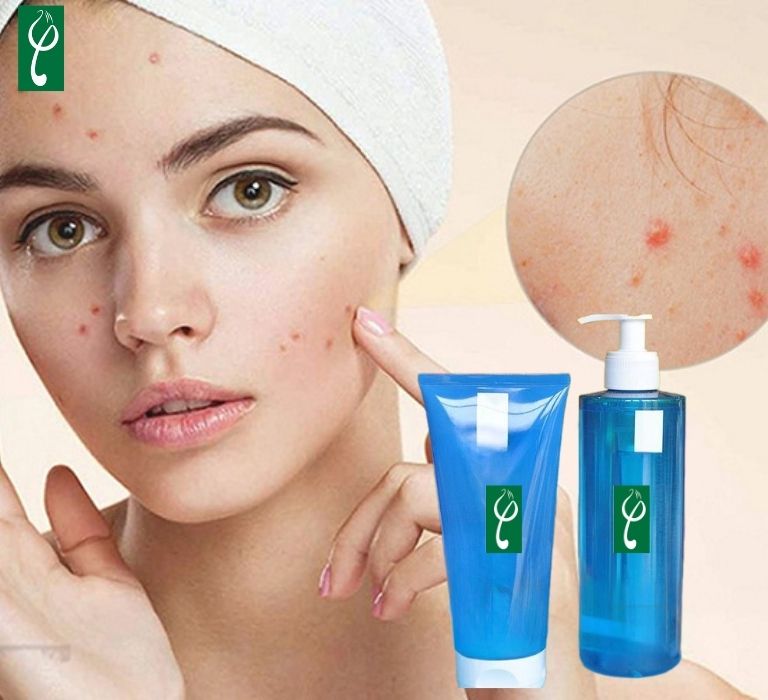 Gia công sữa rửa mặt da mụn