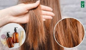 Gia công dầu gội đầu trị tóc khô, xơ