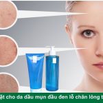 Sữa rửa mặt cho da dầu mụn đầu đen lỗ chân lông to của Nhật