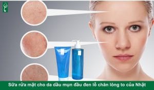 Sữa rửa mặt cho da dầu mụn đầu đen lỗ chân lông to của Nhật