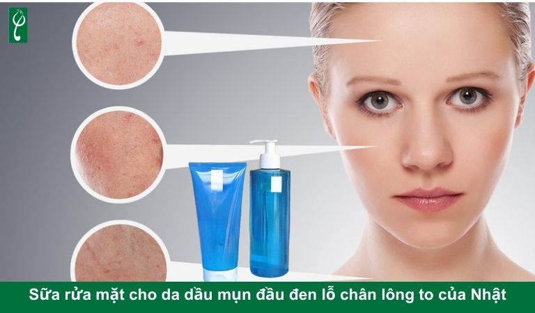 Skincare cho da mụn đầu đen lỗ chân lông to: Giải pháp hiệu quả và an toàn