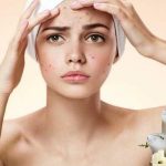 Da mụn có nên dùng sữa tươi rửa mặt không