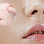Gia công gel tẩy tế bào chết cho da dầu