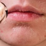 Gia công gel tẩy tế bào chết cho da khô hỗ trợ tái tạo da hiệu quả Gia công gel tẩy tế bào chết cho da khô