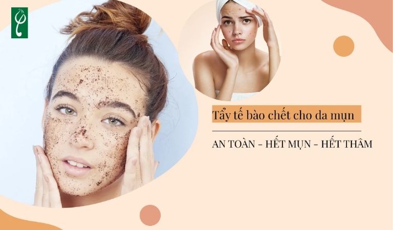 Gia công gel tẩy tế bào chết cho da mụn