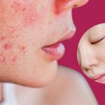 Gia công gel tẩy tế bào chết cho da nhạy cảm
