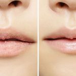 Gia công gel tẩy tế bào chết cho môi