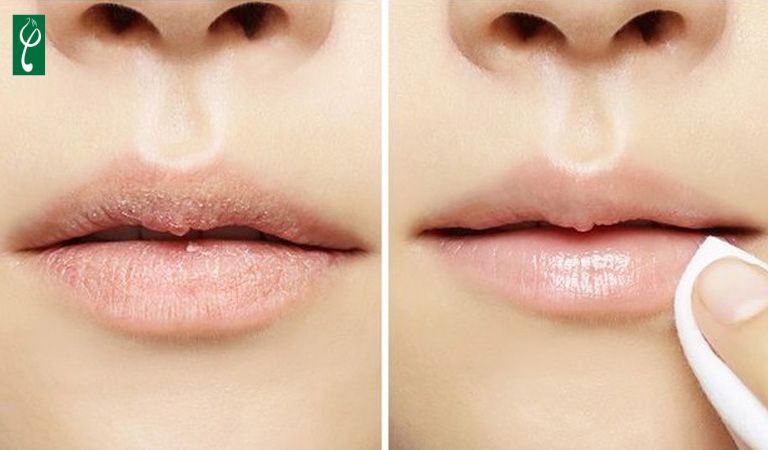 Gia công gel tẩy tế bào chết cho môi