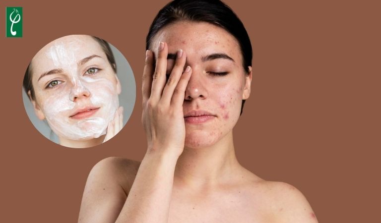 dấu hiệu bị dị ứng sữa rửa mặt