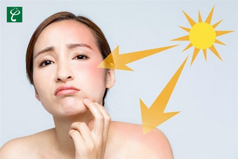 Kem chống nắng giúp bảo vệ làn da trước tác động xấu của ánh nắng mặt trời