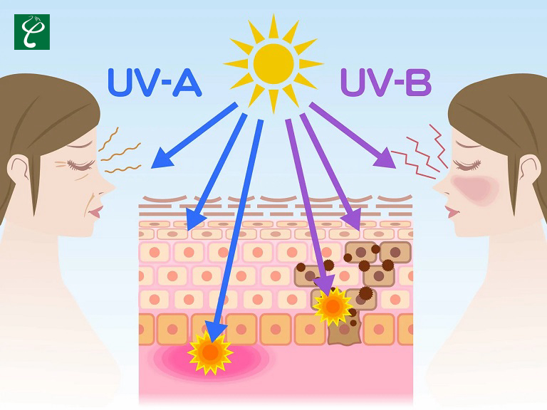 Kem chống nắng là hàng rào bảo vệ da khỏi tác động của tia UV