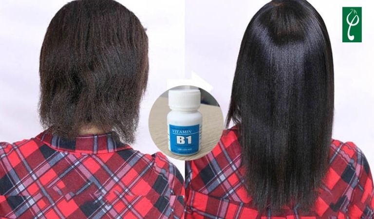 Gội đầu bằng B1 có nhanh dài tóc không