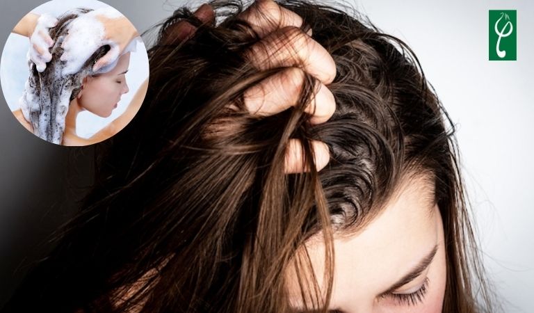 Tóc dầu có nên gội đầu hàng ngày