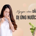dị ứng nước hoa