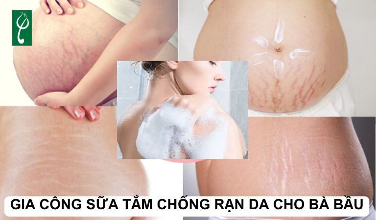 Gia công sữa tắm chống rạn da cho bà bầu