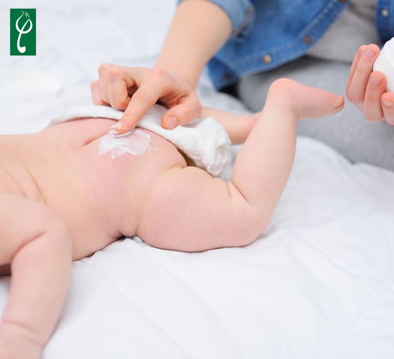 Đột phá doanh thu khi gia công kem trị hăm công thức độc quyền Nhu cầu kem trị hăm tăng cao do có nhiều yếu tố khiến da dễ bị hăm, kích ứng và viêm đỏ