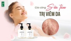 gia cong sua tam tri viem da