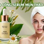 gia công serum trị mụn thảo dược