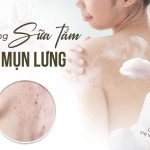 gia công sữa tắm trị mụn lưng