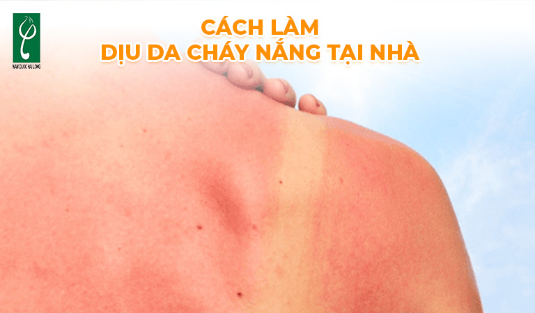 cách làm dịu da cháy nắng tại nhà