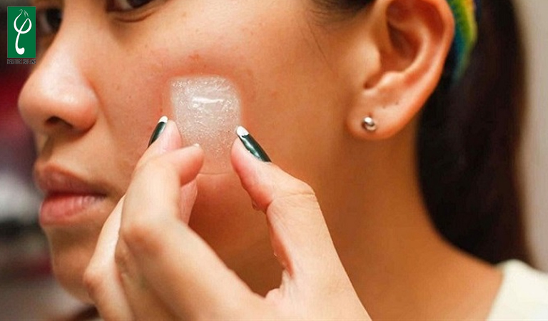 cách làm dịu da cháy nắng tại nhà