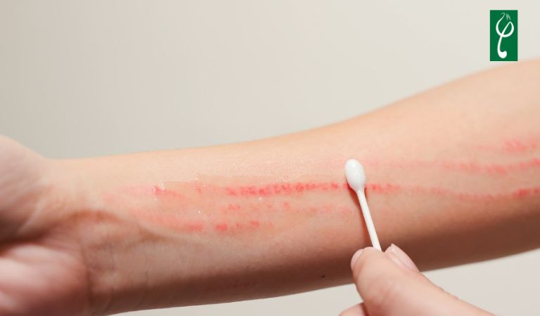 Khử mùi cơ thể bằng chanh nên tránh những vùng da bị trầy xước