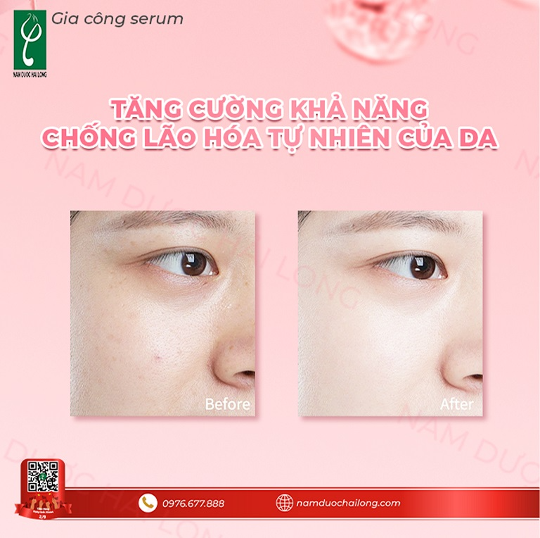 Nhu cầu sử dụng serum tăng cao do người tiêu dùng ngày càng ý thức hơn về việc chăm sóc da chuyên sâu