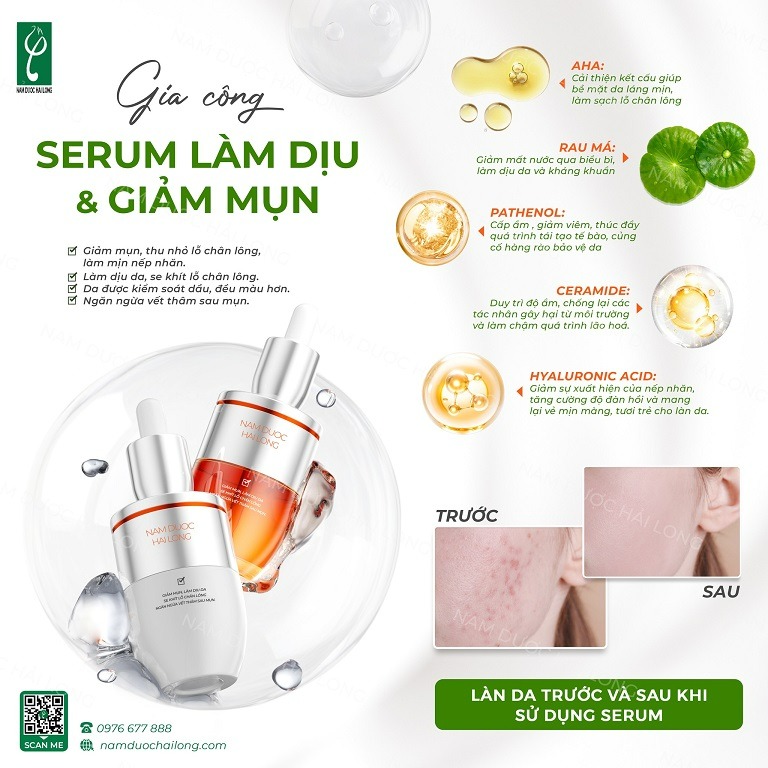 Sản xuất các loại serum đặc trị mụn và kiềm dầu theo yêu cầu