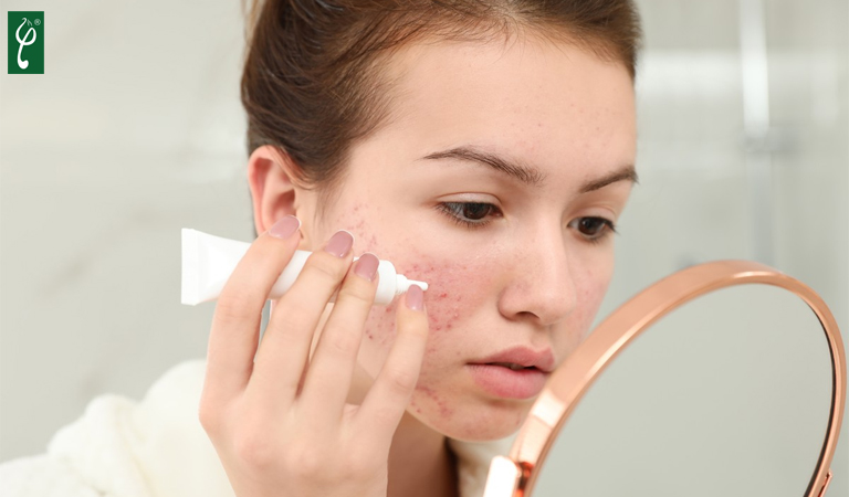 Báo giá gia công kem mụn